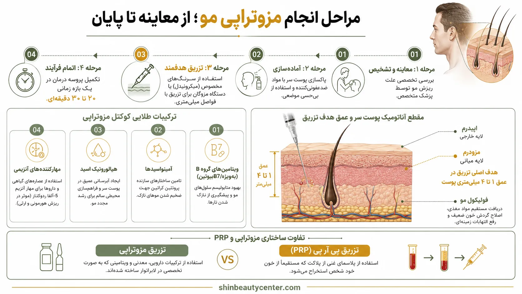نحوه انجام مزوتراپی مو و مراحل درمان